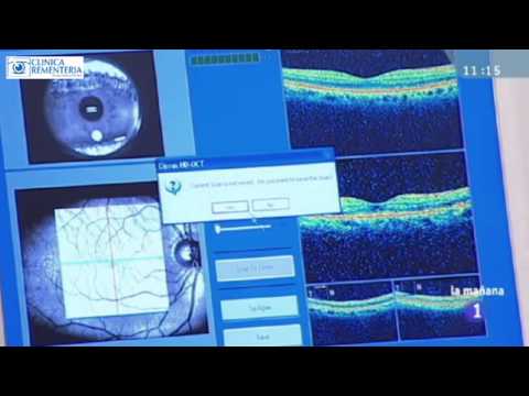 optical coherence tomography tutorial
