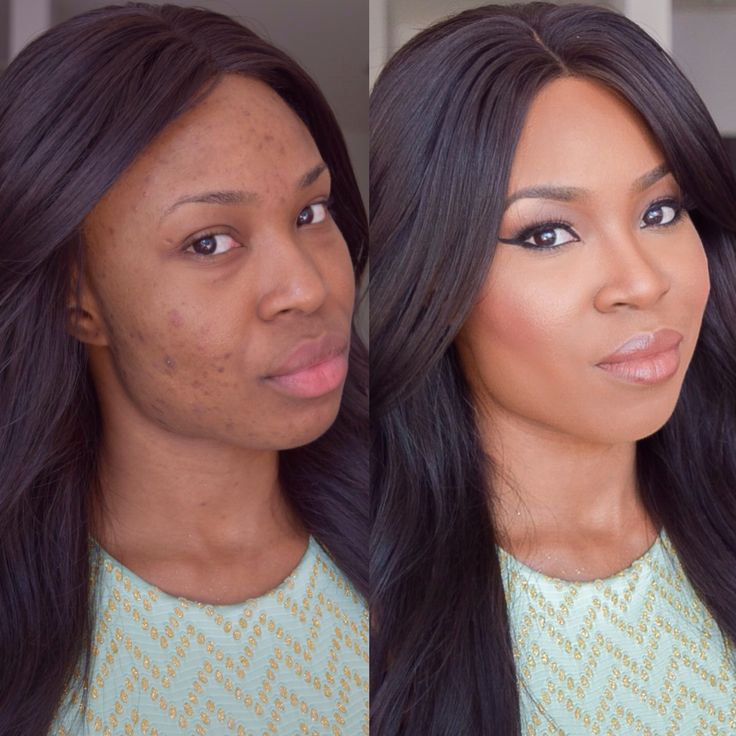 concealer only makeup tutorial